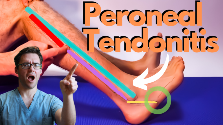 Peroneal Tendonitis Treatment Tendon Pain Stretches Exercises