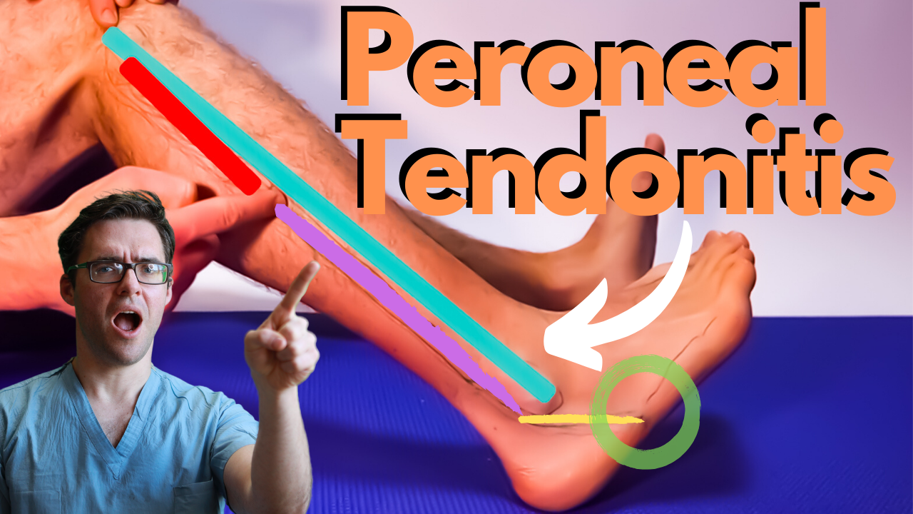 Ankle Tendonitis Treatment Causes Symptoms And Treatment