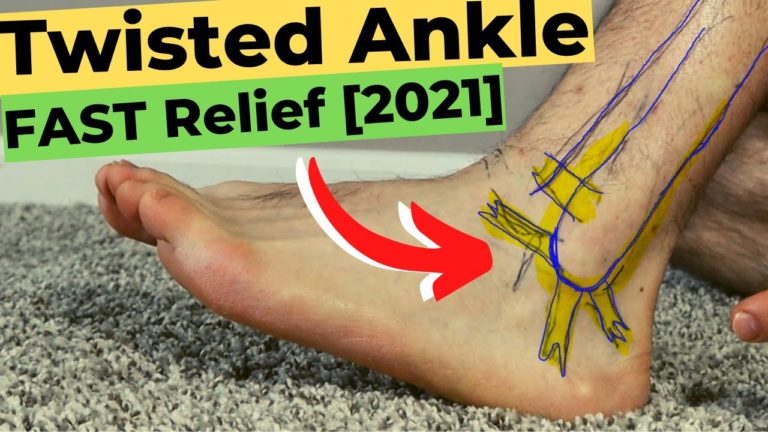 Signs Of Broken Ankle Vs Sprained Ankle Diagnosis And Best Treatment 6738