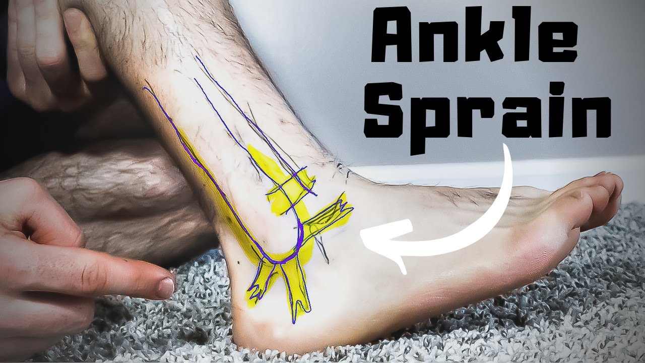 Tendons In Ankle - The Complete Anatomy & Injury Guide!