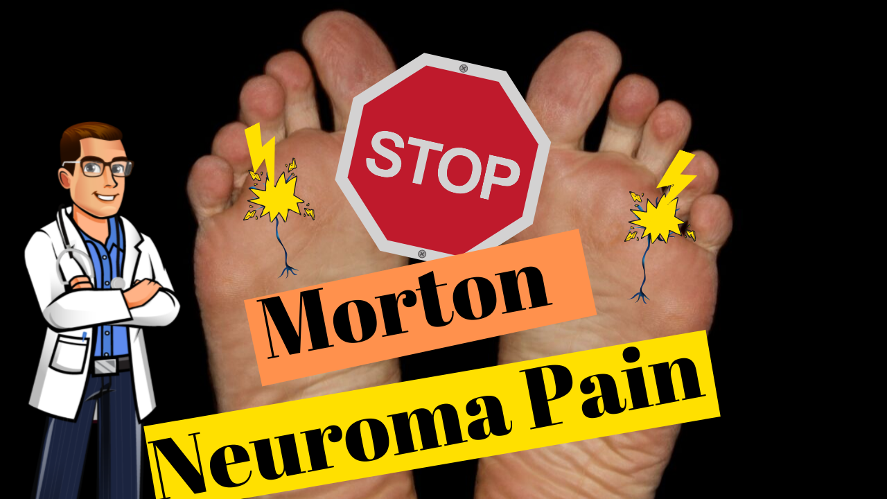 Morton's Neuralgia: [Causes, Symptoms & Best Home Treatment]