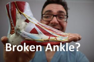 broken ankle