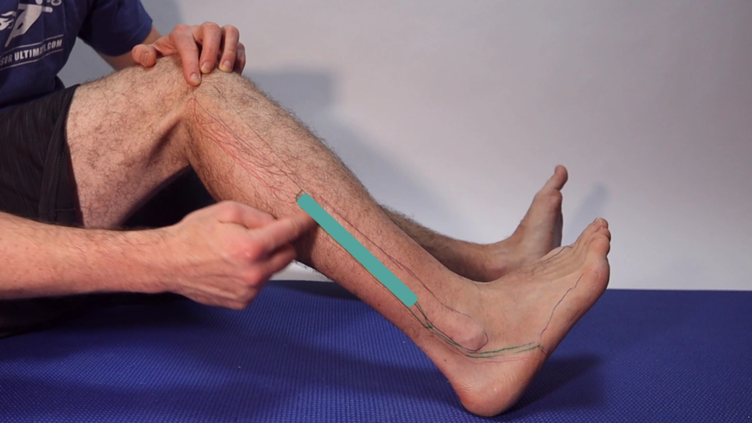 Strained Ankle Tendon & Ligaments: The Treatment Guide!