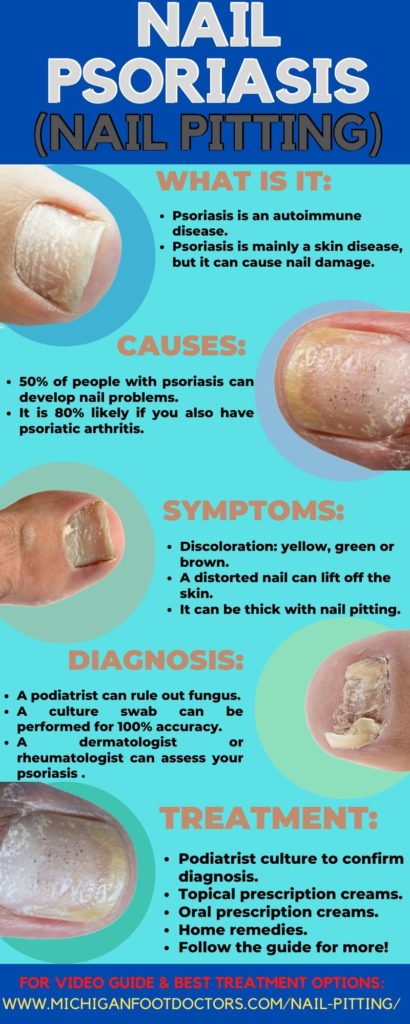 Psoriasis Under The Toenails: [Nail Pits, Causes & Best Treatment]