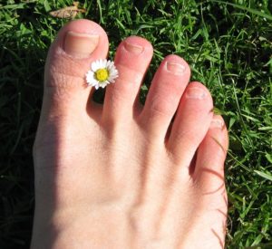 white toenails not fungus