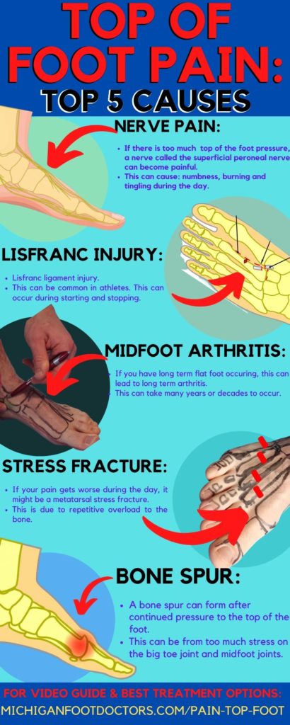 Top Of Foot Pain Causes