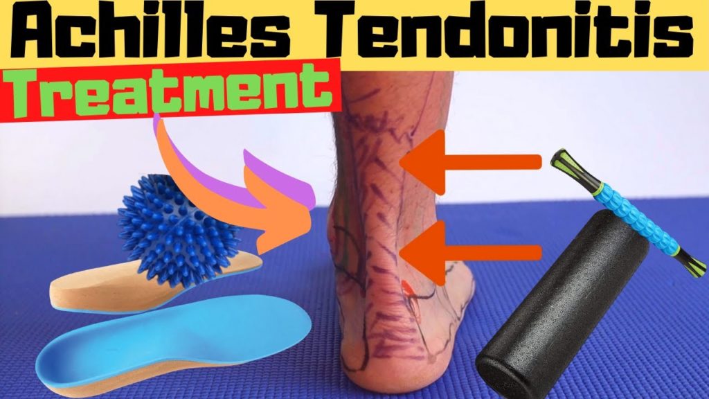 Achilles tendon pain Archives