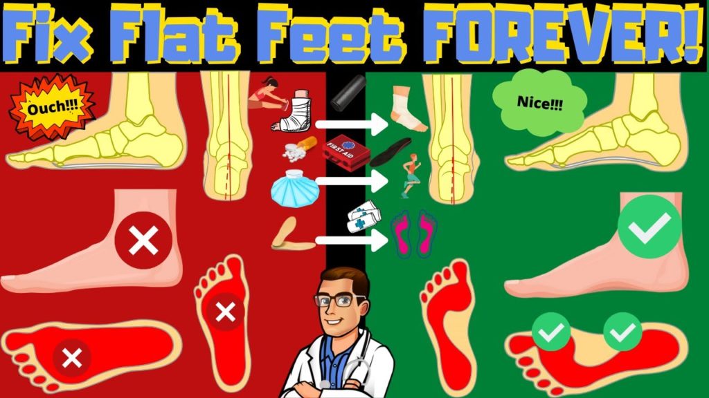 overpronation-vs-supination-how-to-fix-flat-feet-pain-forever