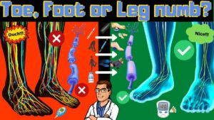 Numbness in Toes, Feet or Legs? [Causes BEST Numb Foot Treatment!]