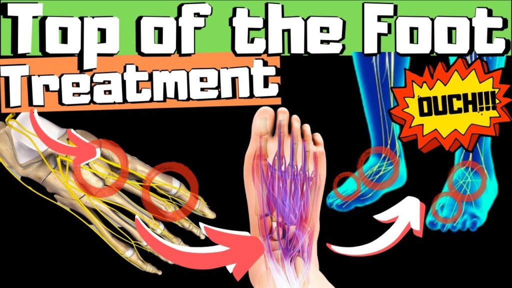 swollen-top-of-foot-or-top-of-foot-tendonitis-fix-top-of-foot-pain