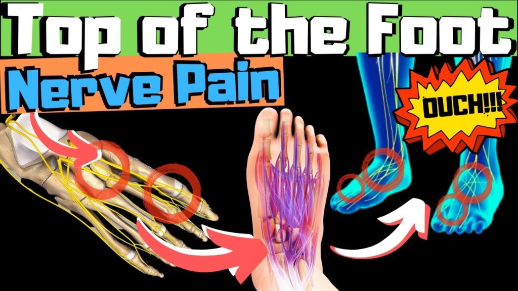 sharp-burning-tingling-top-of-foot-pain-fix-your-nerve-pain