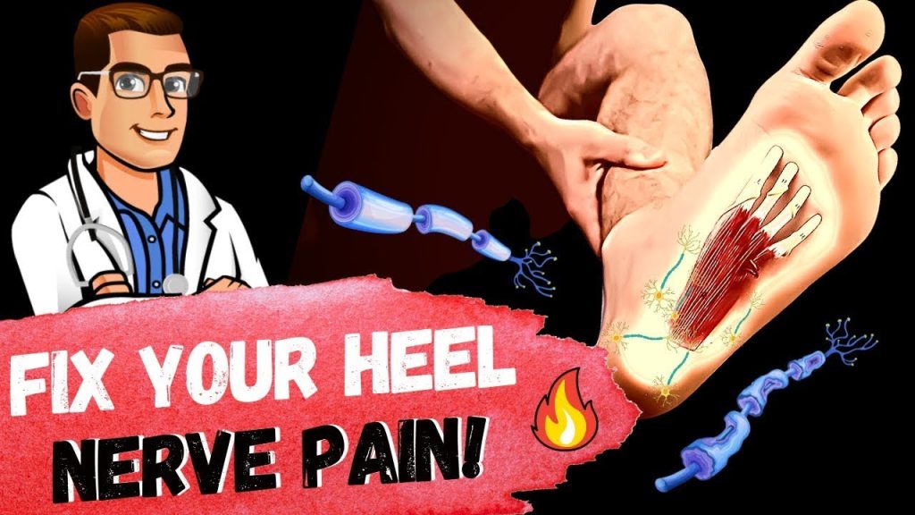 How To Cure Plantar Fasciitis In One Week [plantar Fasciitis Treatment]