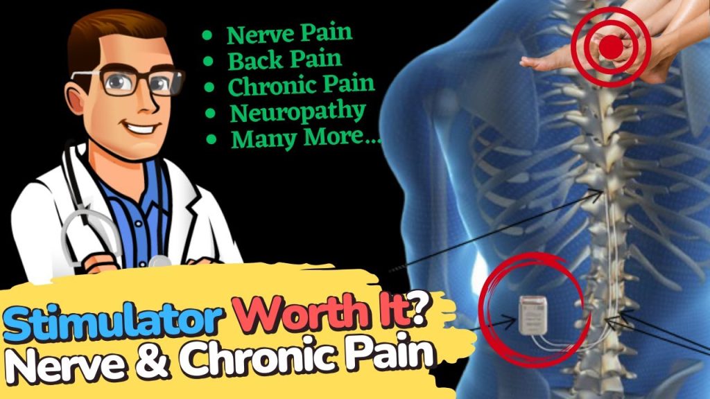 Spinal Cord Stimulator for Chronic Pain? [Neuropathy & Back Pain]