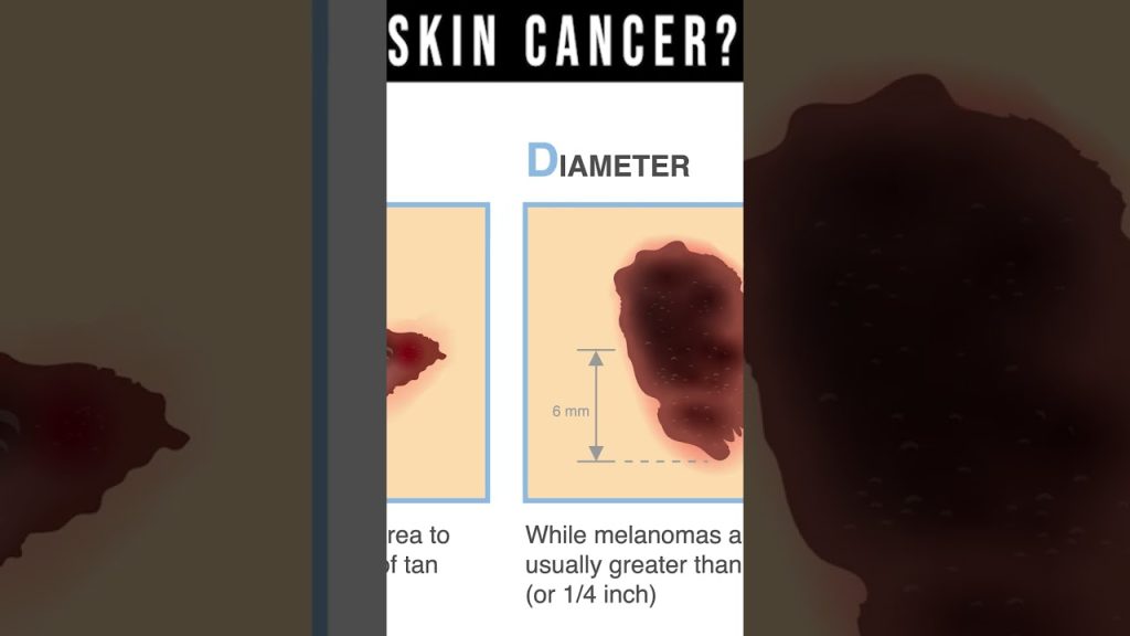 what-does-skin-cancer-look-like-symptoms-pictures-types