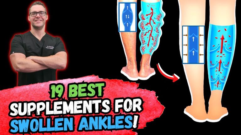 best-19-supplements-to-fix-swollen-feet-ankles