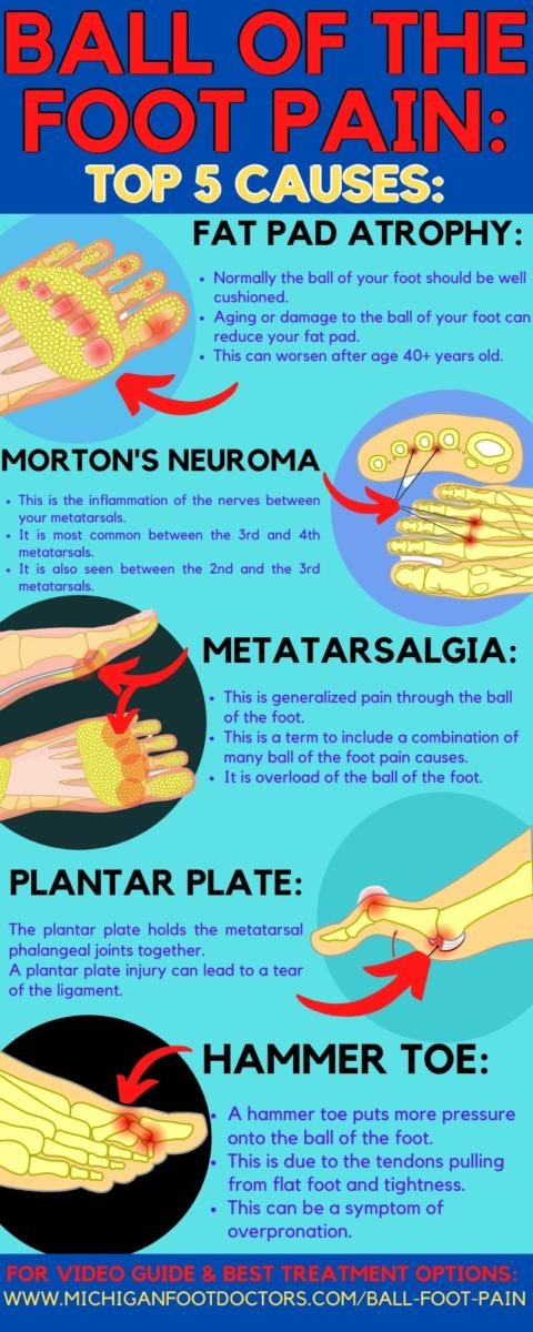 Mulder's Click Test [Best Morton's Neuroma Squeeze TEST]